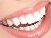 e1461499468347 - جرم گیری دندان با یک محلول خانگی!