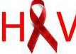 ای وی e1468929879177 - زمان؛ فاکتور تعیین کننده در درمان اچ آی وی