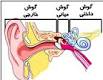 گوش میانی - افرادی که سرگیجه دارند به گوش باشند!