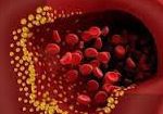 خون e1484409357609 - کاهش چربی خون با این ۵ میوه